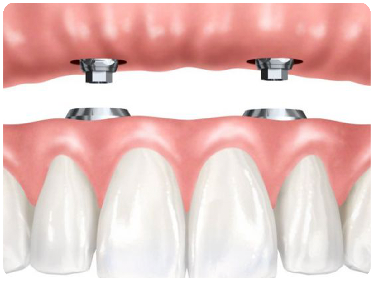 Safe, Comfortable, and Fast Procedures